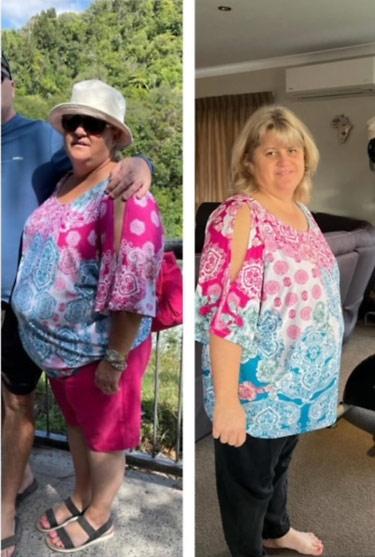 Tanya Before and After